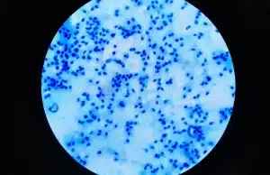 Новая технология, позволяющая создавать сперматозоиды из кожи, вызывает сложные этические дебаты создавать сперматозоиды из кожи